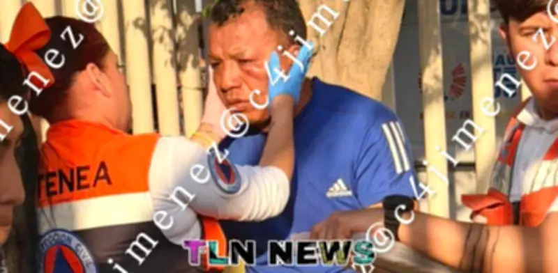 Agentes de la FGJCDMX golpean brutalmente a árbitro tras perder partido en Cuauhtémoc