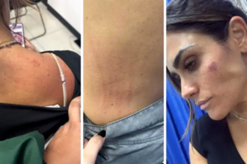 Agreden a alcaldesa de Cuauhtémoc durante conflicto con comerciantes de San Cosme