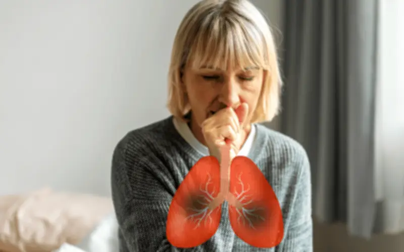 Alerta por Tuberculosis: Casos Respiratorios en Aumento en México