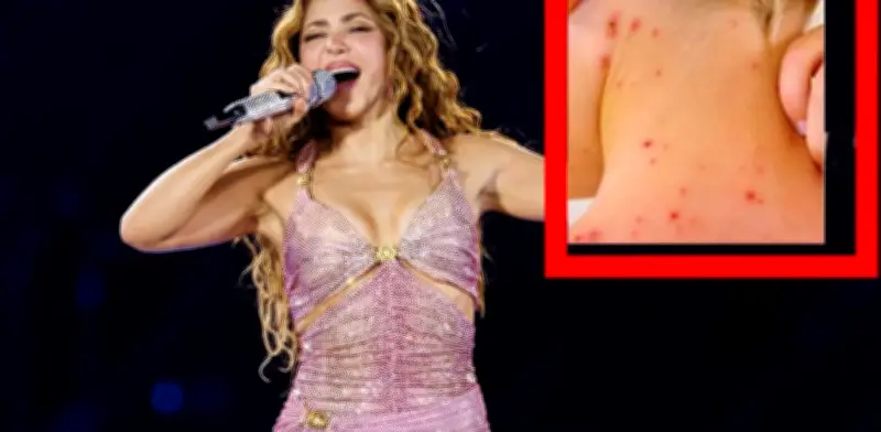 Autoridades descartan riesgo de sarampión en concierto de Shakira en Zócalo CDMX