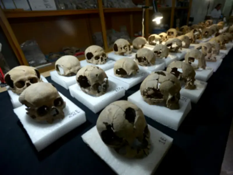 Científicos rusos descubren cirugía maxilofacial de 2.500 años en cráneo de mujer pazyryk