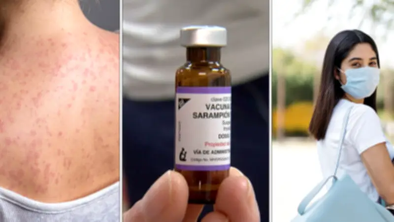 Cubrebocas no detiene sarampión; vacunación masiva es la única solución: experto