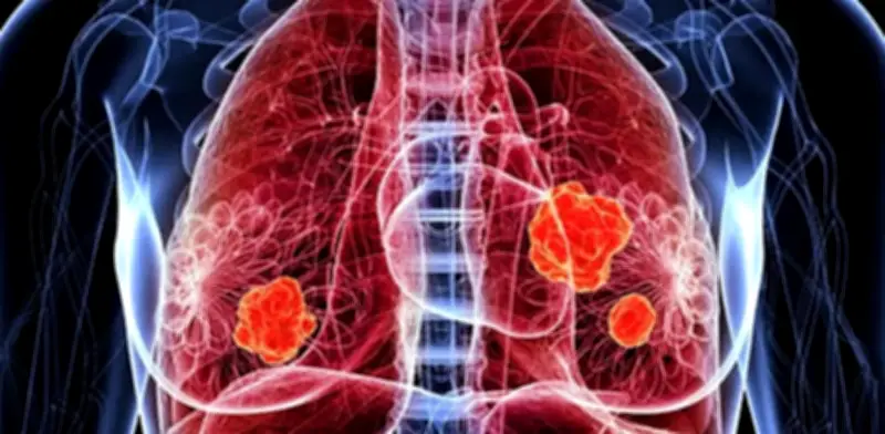 Descubrimiento revolucionario: Un fármaco antiguo activa directamente la proteína STING para potenciar la inmunoterapia contra el cáncer