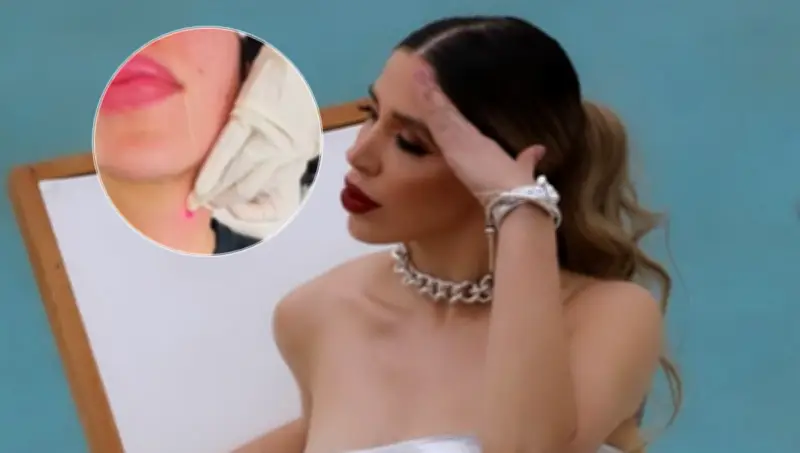 Emma Coronel revela su tratamiento Endolift para reducir la papada en video viral