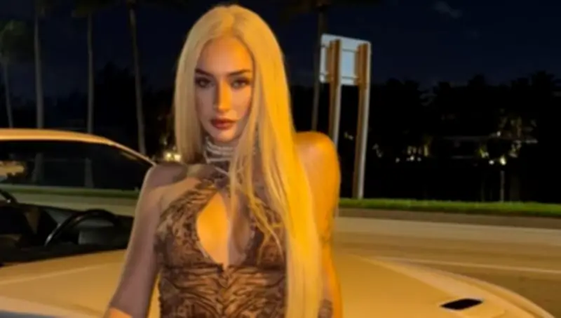 Exestrella de reality show atropella a repartidor en Chile: joven está grave