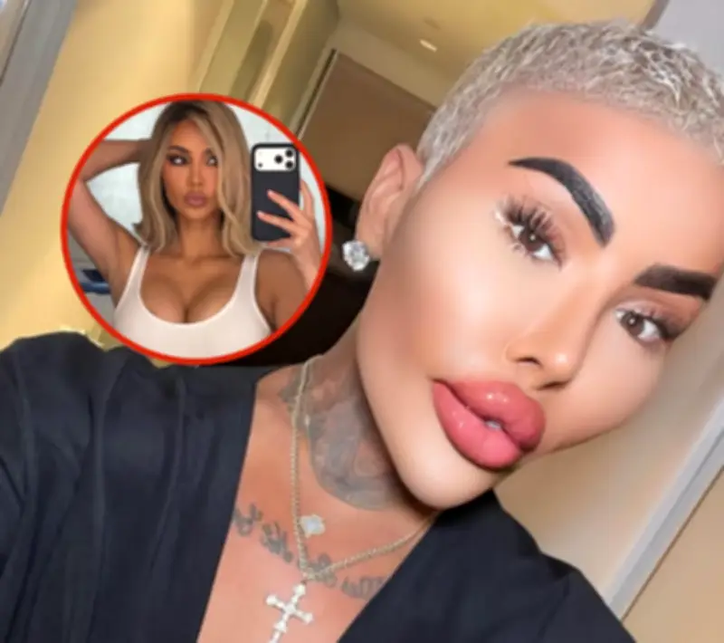 Fallece influencer Jordan James Parke tras cirugía estética; invertía millones para parecerse a Kim Kardashian