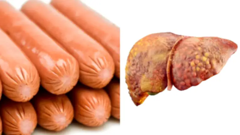 Hígado graso: el riesgo oculto de los embutidos como salchicha, jamón y chorizo