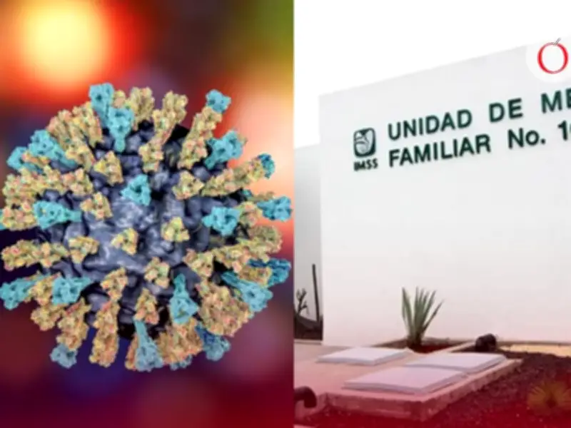 IMSS otorga hasta un año de incapacidad por sarampión: requisitos y trámite