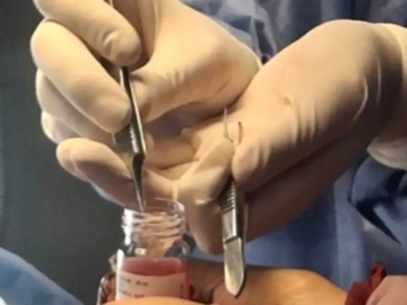 ISSSTE Querétaro realiza procuración de órganos que beneficiará a más de 100 pacientes