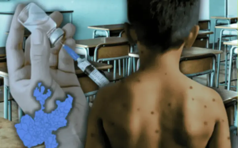 Jalisco: 43 escuelas afectadas por brote de sarampión; solo 5 suspendieron turnos completos