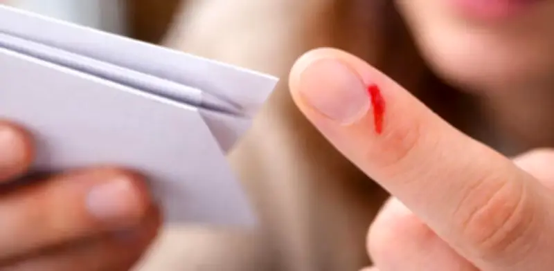 ¿Por qué un simple corte con papel duele tanto? La ciencia detrás del dolor intenso