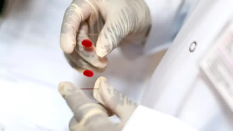 Pruebas gratuitas de VIH, hepatitis C y sífilis en CDMX: sin cita y confidenciales