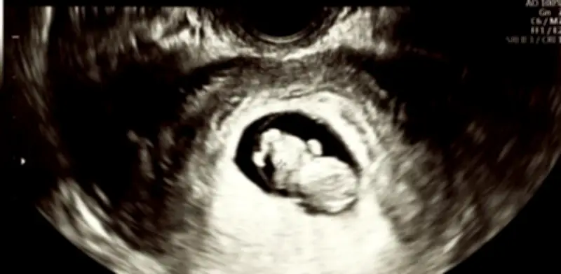 Puerto Rico reconoce personalidad jurídica al no nacido y endurece su código penal