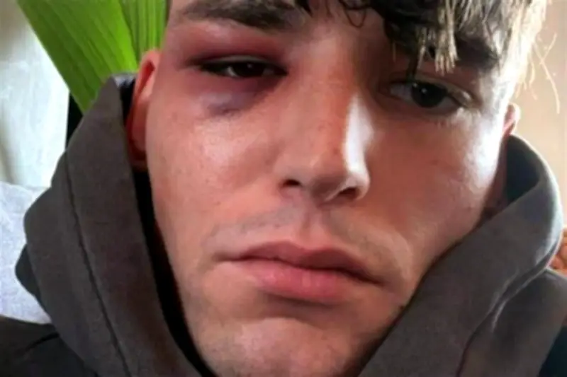 Árbitro alemán es acusado de simular una agresión homofóbica en partido de fútbol