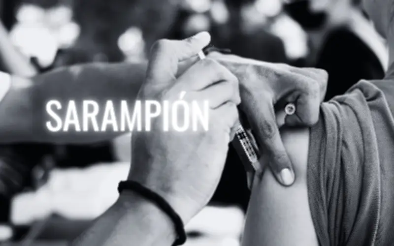 Sarampión en Jalisco: Primera muerte de 2026 y liderazgo nacional en contagios