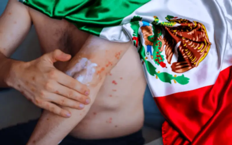 Sarampión en México: 90% de casos en no vacunados y lista de estados más afectados