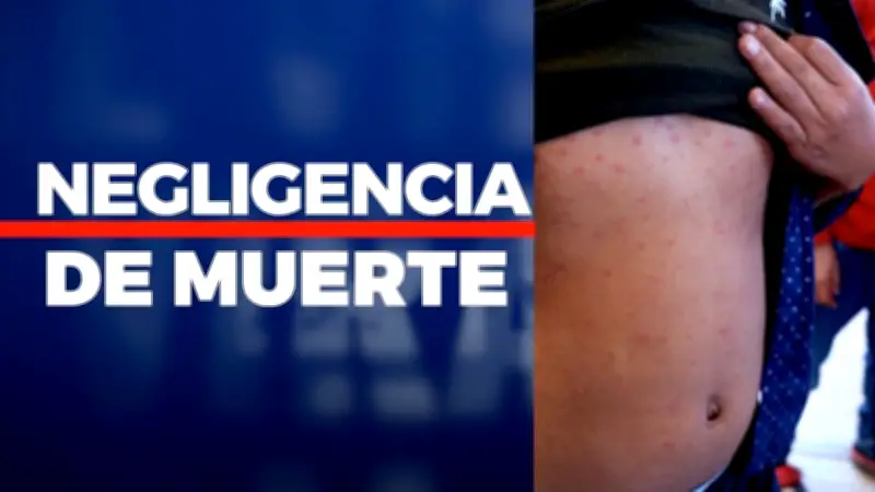 Sarampión en México: Epidemia crece con casos en 7 estados y alerta mundial