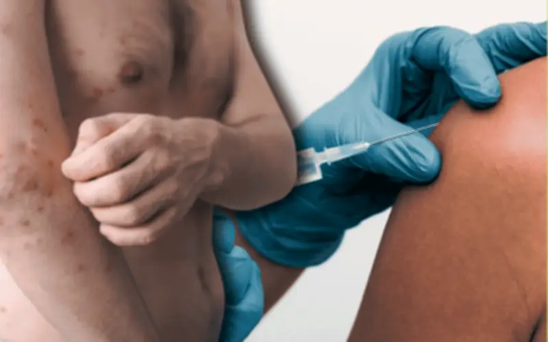 Sarampión en México: ¿Puedes enfermarte aún vacunado? Autoridades explican