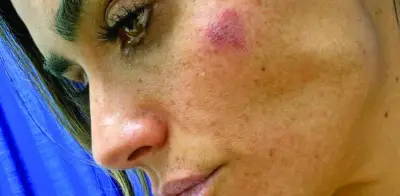 Alcaldesa Alessandra Rojo de la Vega denuncia agresión física en operativo de San Cosme