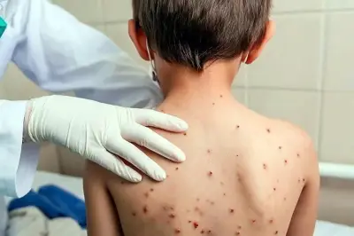 Exigen penalizar a funcionarios por muertes por sarampión en México