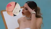 Emma Coronel revela su tratamiento Endolift para reducir la papada en video viral