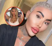 Fallece influencer Jordan James Parke tras cirugía estética; buscaba parecerse a Kim Kardashian