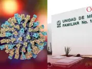 IMSS otorga hasta un año de incapacidad por sarampión: requisitos y trámite