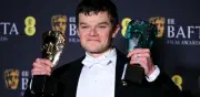 Robert Aramayo vence a DiCaprio y Chalamet en los BAFTA: un triunfo histórico