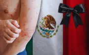 Sarampión en México: Confirman 28 muertes y un caso pendiente elevaría cifra a 29