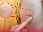 Sheinbaum aclara: la cicatriz en el brazo no es de la vacuna del sarampión