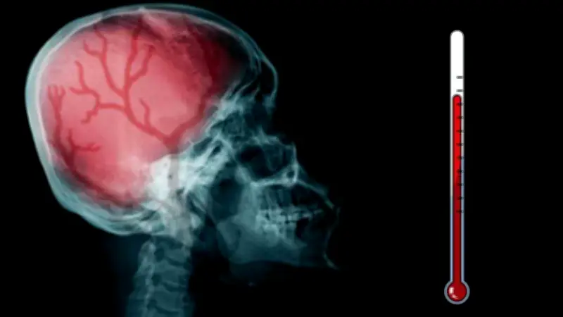 Brote de meningitis sin precedentes en Reino Unido: 20 casos y dos muertes confirmadas