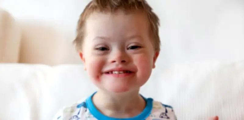 Científicos eliminan cromosoma extra del síndrome de Down con CRISPR-Cas9 en células humanas