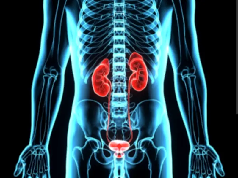 Cáncer de Vejiga y Riñón: Sangre en Orina es Señal de Alerta que No Debe Ignorarse