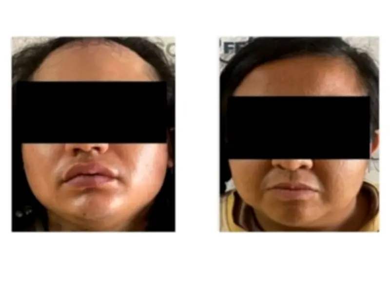 Condenan a 37 años a padrastro por feminicidio y abuso de niña de 2 años en Jalisco