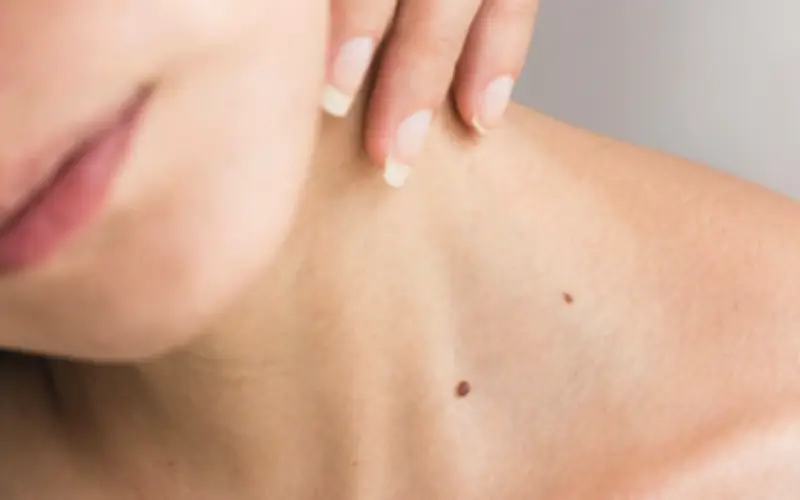 Cuidados esenciales para mantener la firmeza de la piel del cuello y prevenir arrugas