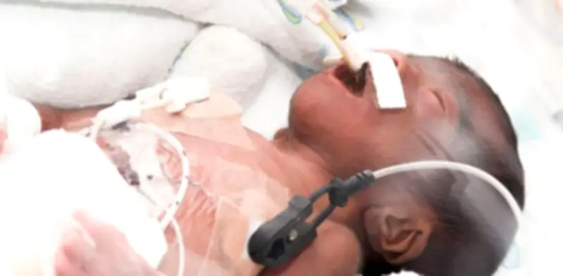 Día Mundial del Síndrome de Edwards: Conmemoración y Conciencia sobre la Trisomía 18