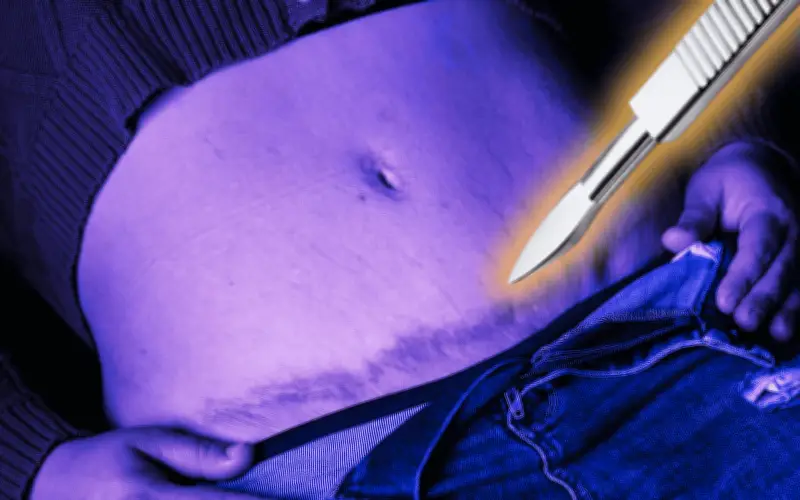 Diputada del PAN en CDMX propone prohibir cirugías estéticas en menores de edad