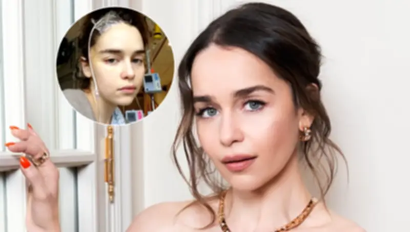 Emilia Clarke: La lucha secreta contra dos aneurismas cerebrales durante Game of Thrones