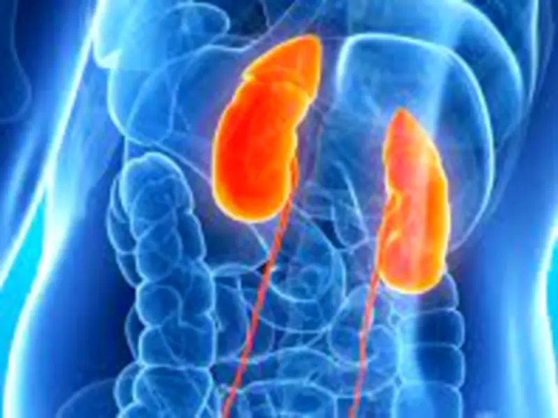 Enfermedad Renal Crónica: Un asesino silencioso que afecta al 12% de mexicanos