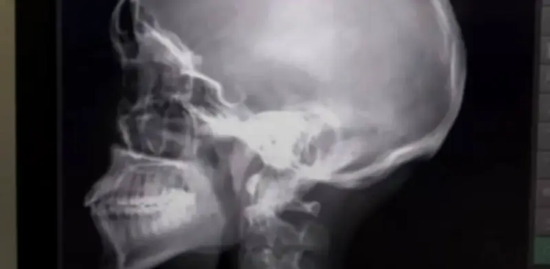 Estudiante del CBTIS 24 sufre golpiza brutal; señalan a compañeros como agresores