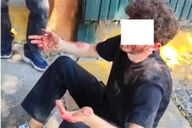 Estudiante Extranjero Agredido en Funeral de 'El Mencho' en Jalisco