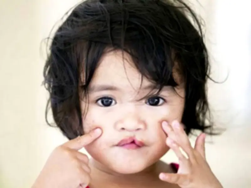 Estudiantes lideran maratón de fútbol de 24 horas para financiar cirugías infantiles en México