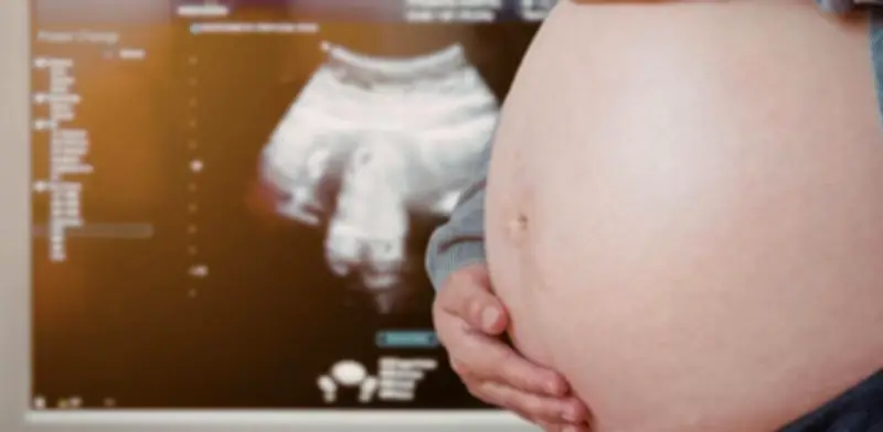 Estudio revela que el 40% de complicaciones graves del embarazo pasan inadvertidas