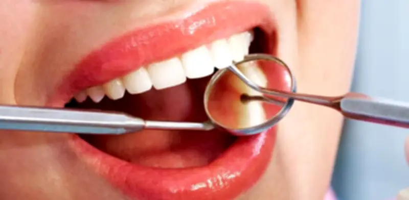 Exceso de azúcar impacta gravemente la salud bucal de jóvenes mexicanos