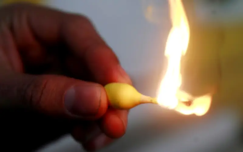 IMSS advierte: remedios caseros como mostaza agravan quemaduras y ponen en riesgo la vida