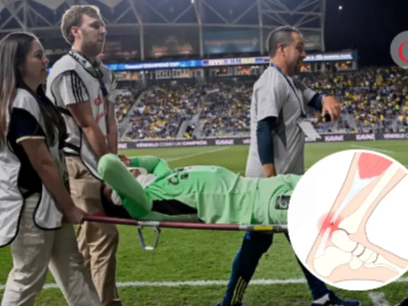 Malagón sufre grave ruptura de tendón de Aquiles: lesión que amenaza su temporada