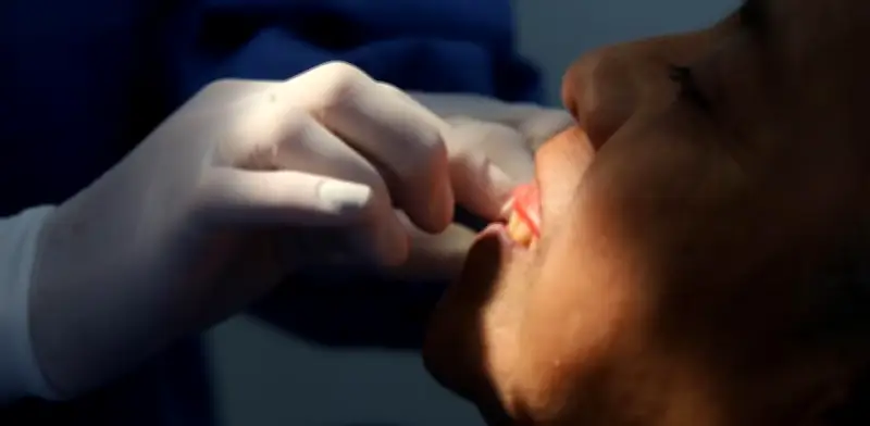 Mexicanos visitan al dentista cada 8 años: el alto costo de descuidar la salud bucal
