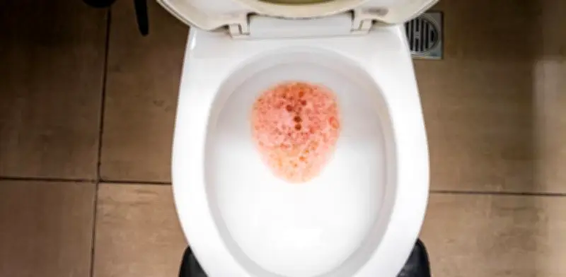 Orina Espumosa: ¿Señal de Alerta para la Salud Renal?