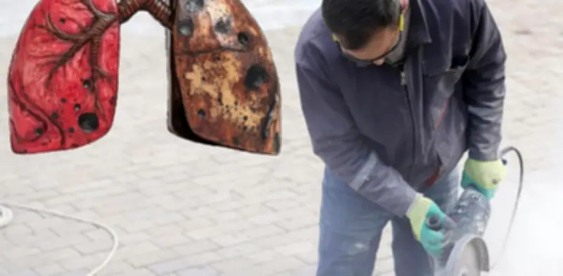 Silicosis: La Enfermedad Pulmonar que Devasta a los Trabajadores de la Construcción