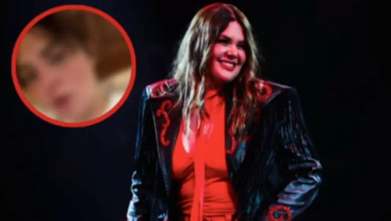 Yuridia revela quemadura facial por medicamento y pide ayuda dermatológica en redes